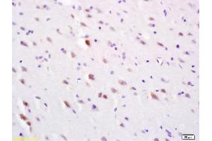 Formalin-fixed and paraffin embedded rat brain labeled with Anti-SLC30A3/ZNT3 Polyclonal Antibody, Unconjugated (ABIN1386246) at 1:200 followed by conjugation to the secondary antibody and DAB staining