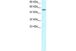 Human HepG2; WB Suggested Anti-RUNX1T1 Antibody Titration: 1.