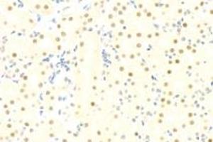 Immunohistochemistry analysis of paraffin-embedded mouse kidney using mSin3A (ABIN7075609) at dilution of 1: 100