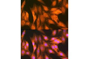 Immunofluorescence analysis of C6 cells using F/UBD Rabbit mAb (ABIN7271134) at dilution of 1:100 (40x lens). (UBD anticorps)