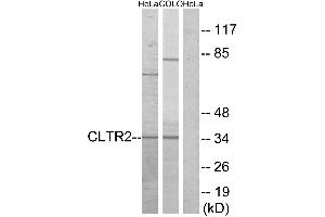 Western blot analysis of extracts from HeLa cells and COLO cells, using CLTR2 antibody. (CasLTR2 anticorps  (Internal Region))