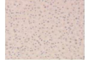 Detection of SIRT6 in Mouse Liver Tissue using Polyclonal Antibody to Sirtuin 6 (SIRT6) (SIRT6 anticorps  (AA 1-334))