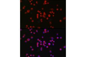 Immunofluorescence analysis of Neuro-2a cells using nNOS Rabbit mAb (ABIN1680436, ABIN1680435, ABIN7101483 and ABIN7101484) at dilution of 1:100 (40x lens). (NOS1 anticorps)