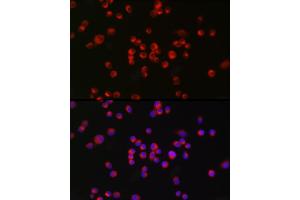 Immunofluorescence analysis of Neuro-2a cells using nNOS Rabbit mAb (ABIN1680436, ABIN1680435, ABIN7101483 and ABIN7101484) at dilution of 1:100 (40x lens).