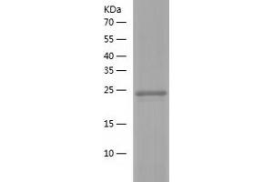 Western Blotting (WB) image for G Protein-Coupled Receptor 114 (GPR114) (AA 22-250) protein (His-IF2DI Tag) (ABIN7123030)