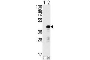 Image no. 1 for anti-SRY (Sex Determining Region Y)-Box 2 (SOX2) antibody (ABIN357439) (SOX2 anticorps)