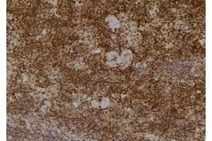 ABIN6277231 at 1/100 staining Mouse spleen tissue by IHC-P. (PSMA2 anticorps  (Internal Region))
