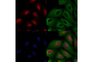 ABIN6260147 and ABIN6266767 staining  cells by IF/ICC. (ATRX anticorps  (N-Term))