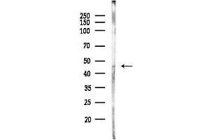 Western blot analysis of lysates from PC12 cells(heat-shock,45 min treatment), using CATSPER3 Antibody at 1/1000 dilution.