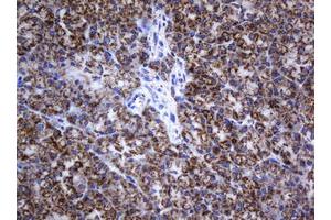 Image no. 2 for anti-NADH Dehydrogenase (Ubiquinone) 1 beta Subcomplex, 10, 22kDa (NDUFB10) antibody (ABIN1499672) (NDUFB10 anticorps)