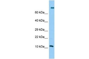 Host: Rabbit Target Name: PLA2G2C Sample Type: Jurkat Whole Cell lysates Antibody Dilution: 1. (PLA2G2C anticorps  (Middle Region))