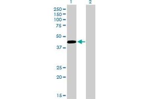 Western Blot analysis of PAX5 expression in transfected 293T cell line by PAX5 monoclonal antibody (M01), clone 8F9.