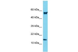 Host: Rabbit Target Name: Arpc5 Sample Type: Mouse Small Intestine lysates Antibody Dilution: 1. (ARPC5 anticorps  (N-Term))