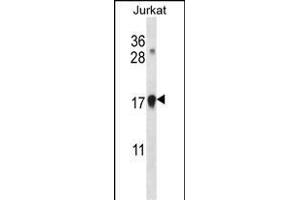 CDKN1A Antibody (C-term) (ABIN657391 and ABIN2846432) western blot analysis in Jurkat cell line lysates (35 μg/lane). (p21 anticorps  (C-Term))