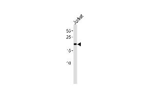 MGMT Antibody (C-term) (ABIN391514 and ABIN2841475) western blot analysis in Jurkat cell line lysates (35 μg/lane). (MGMT anticorps  (C-Term))