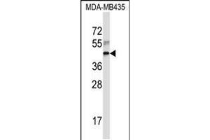 Western blot analysis in MDA-MB435 cell line lysates (35ug/lane). (RPL3 anticorps  (AA 224-251))