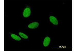 Immunofluorescence of purified MaxPab antibody to WHSC2 on HeLa cell. (WHSC2 anticorps  (AA 1-528))