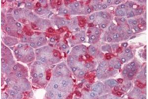 Human Pancreas: Formalin-Fixed, Paraffin-Embedded (FFPE)