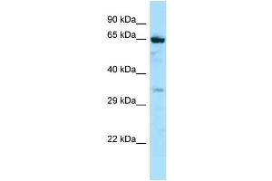 Host: Rabbit Target Name: NOX5 Sample Type: Jurkat Whole Cell lysates Antibody Dilution: 1. (NOX5 anticorps  (C-Term))