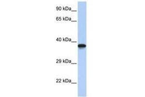 Image no. 1 for anti-DMRT-Like Family C2 (DMRTC2) (AA 72-121) antibody (ABIN6740463) (DMRTC2 anticorps  (AA 72-121))
