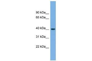 BVES antibody used at 1 ug/ml to detect target protein. (BVES anticorps  (Middle Region))