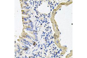 Immunohistochemistry of paraffin-embedded mouse lung using MYH7 antibody at dilution of 1:100 (x40 lens). (MYH7 anticorps)