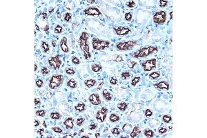 Immunohistochemistry of paraffin-embedded rat kidney using MUC1 Rabbit pAb (ABIN6131522, ABIN6144194, ABIN6144195 and ABIN6213810) at dilution of 1:100 (40x lens).