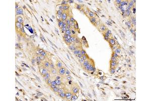IHC analysis of CYB5B using anti-CYB5B antibody (ABIN7600312).