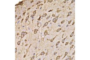 Immunohistochemistry of paraffin-embedded mouse brain using RPS14 antibody.