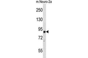 ZDHHC8 Antibody (C-term) western blot analysis in mouse Neuro-2a cell line lysates (35 µg/lane). (ZDHHC8 anticorps  (C-Term))