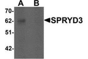 Western blot analysis of SPRYD3 in human brain tissue lysate with SPRYD3 antibody at 1 μg/ml in (A) the absence and (B) the presence of blocking peptide. (SPRYD3 anticorps  (Center))