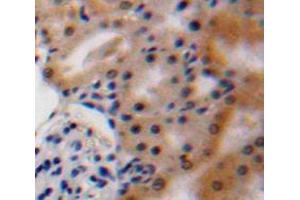 Used in DAB staining on fromalin fixed paraffin-embedded Kidney tissue (VEGFA anticorps  (AA 27-146))