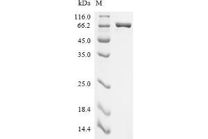 (Tris-Glycine gel) Discontinuous SDS-PAGE (reduced) with 5 % enrichment gel and 15 % separation gel.