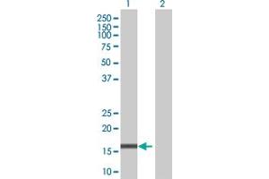 Lane 1: CEBPG transfected lysate ( 16. (CEBPG 293T Cell Transient Overexpression Lysate(Denatured))
