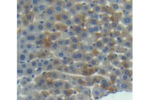 Used in DAB staining on fromalin fixed paraffin- embedded liver tissue (RGS10 anticorps  (AA 16-181))