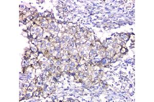 IHC analysis of TIMM17A using anti-TIMM17A antibody (ABIN6719637).