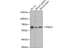 Western blot analysis of extracts of various cell lines, using TRIM23 antibody (ABIN6131175, ABIN6149508, ABIN6149509 and ABIN6224352) at 1:1000 dilution. (TRIM23 anticorps  (AA 1-280))
