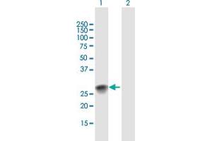 Western Blot analysis of SSX2 expression in transfected 293T cell line by SSX2 MaxPab polyclonal antibody. (SSX2 anticorps  (AA 1-188))