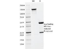 SDS-PAGE Analysis Purified PLGF Monoclonal Antibody (PLGF/93). (PLGF anticorps)