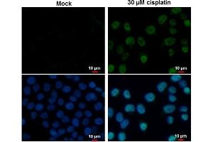 ICC/IF Image p53 antibody [N1], N-term detects p53 protein at nucleus by immunofluorescent analysis.