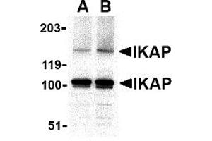 Western Blotting (WB) image for anti-Elongator Complex Protein 1 (ELP1) (C-Term) antibody (ABIN1030431) (IKAP/p150 anticorps  (C-Term))