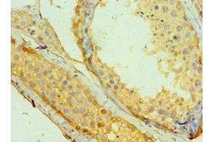 Immunohistochemistry of paraffin-embedded human testis tissue using ABIN7159251 at dilution of 1:100 (MAGEA1 anticorps  (AA 1-309))