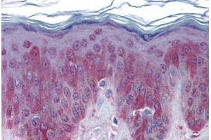 Human Skin: Formalin-Fixed, Paraffin-Embedded (FFPE)