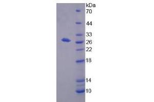 SDS-PAGE analysis of Human BPGM Protein. (BPGM Protéine)