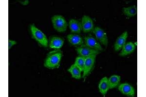 Immunofluorescent analysis of A549 cells using ABIN7142174 at dilution of 1:100 and Alexa Fluor 488-congugated AffiniPure Goat Anti-Rabbit IgG(H+L) (OAS3 anticorps  (AA 424-565))
