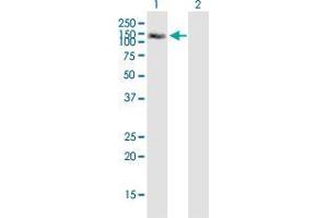 Western Blot analysis of MAP3K13 expression in transfected 293T cell line by MAP3K13 monoclonal antibody (M04), clone 4H7.