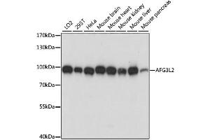 Western blot analysis of extracts of various cell lines, using AFG3L2 antibody (ABIN6292744) at 1:1000 dilution. (AFG3L2 anticorps)