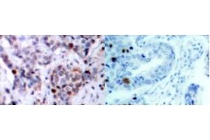 Image no. 2 for anti-Nuclear Factor-kB p65 (NFkBP65) (pThr435) antibody (ABIN318087) (NF-kB p65 anticorps  (pThr435))