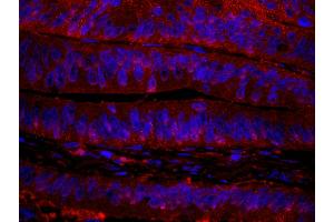 Immunofluorescence (IF) image for anti-RAN Binding Protein 1 (RANBP1) (AA 1-50) antibody (ABIN7449008) (RANBP1 anticorps  (AA 1-50))