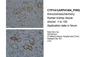 Sample Type: Human KidneyDilution: 1:100 (CYP1A1 anticorps  (Middle Region))